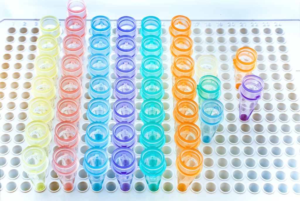 Inimgeeniuuringute seadus_PCR rack_labor.jpeg